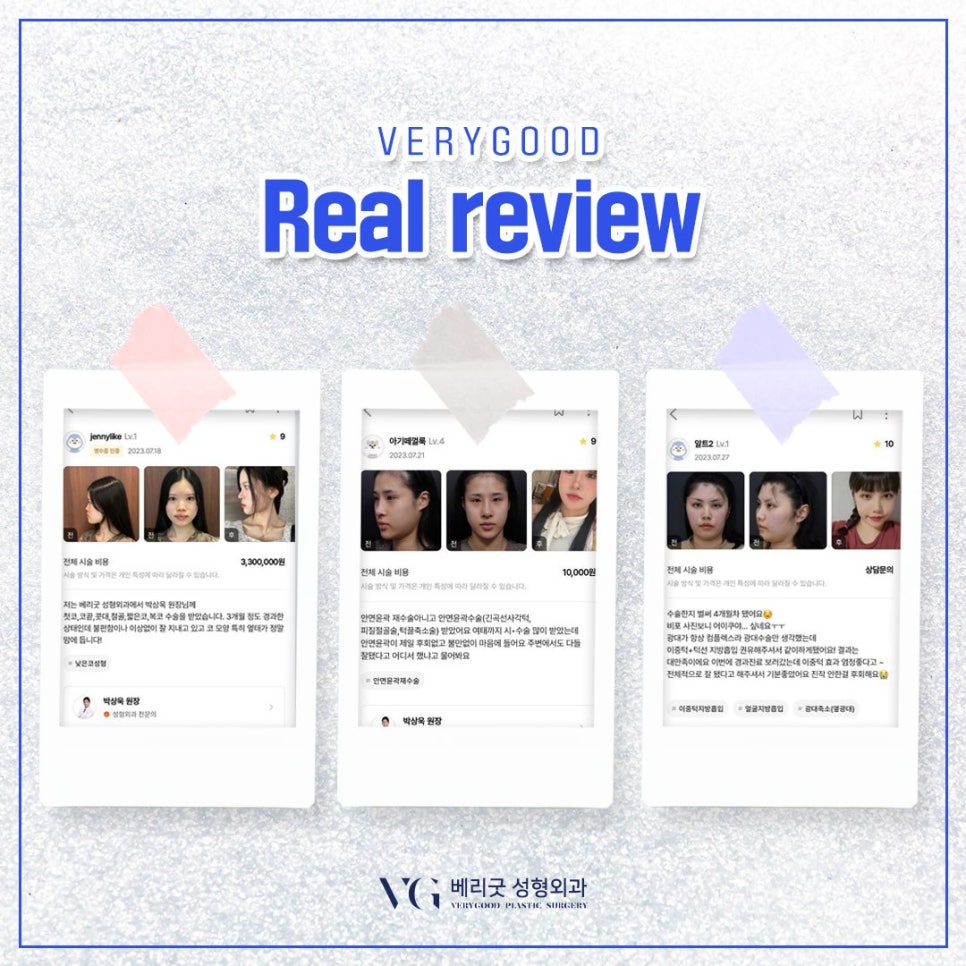 코수술 후기 모음 zip. #1｜베리굿성형외과 8월 코성형 주간지 관련 이미지 5