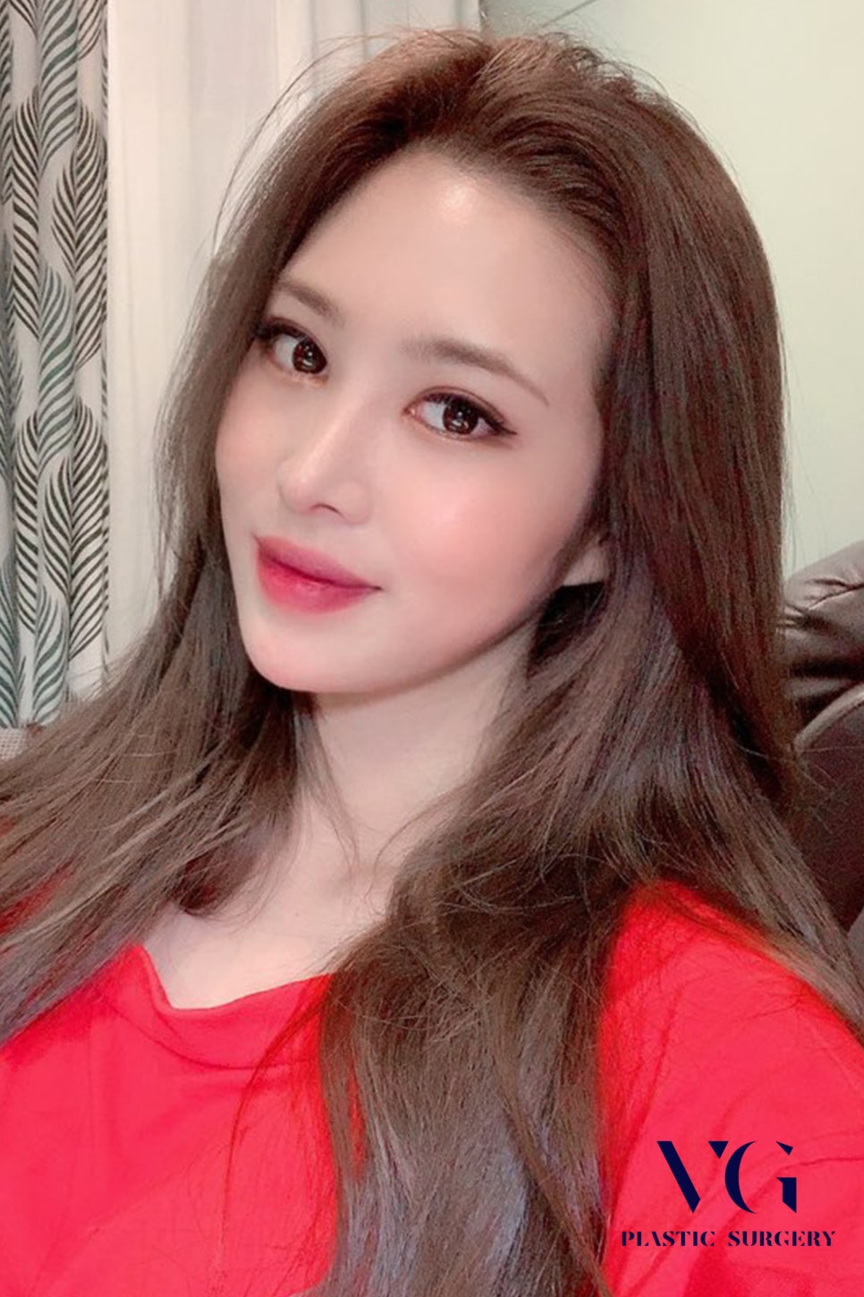 베리굿 눈재수술로 마지막을 완성하다! 관련 이미지 3