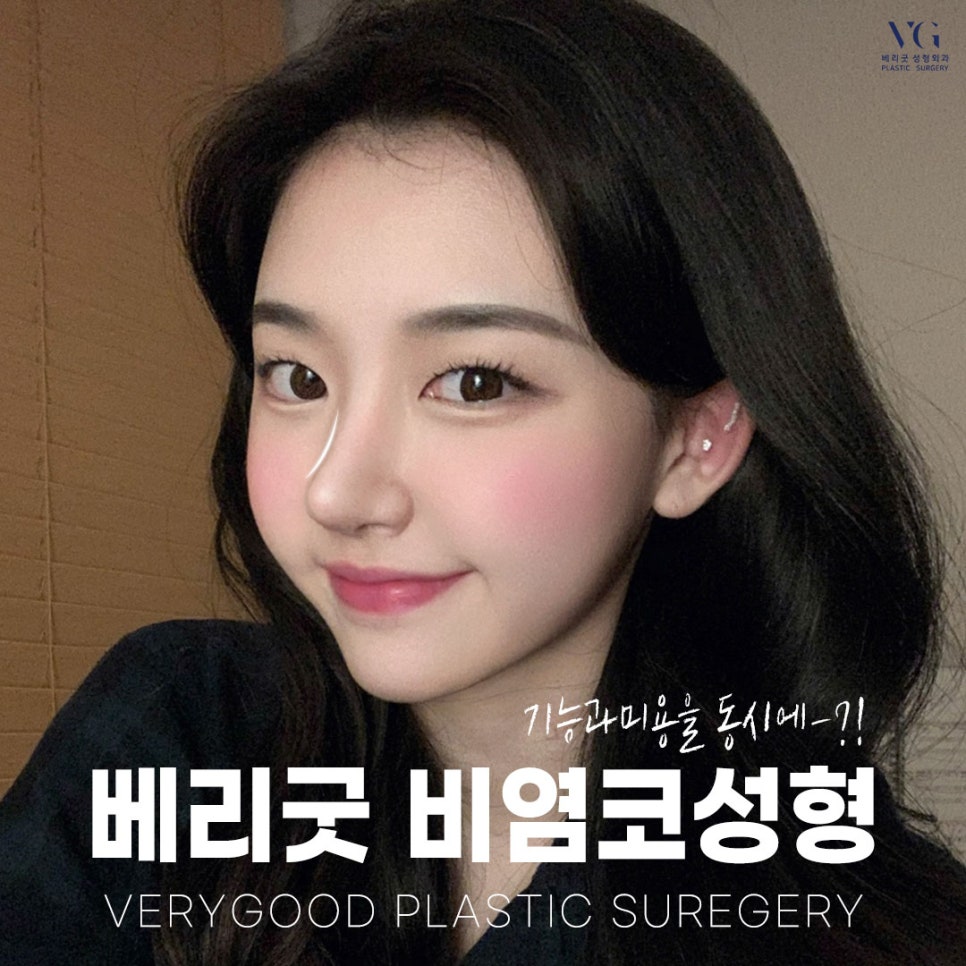기능코성형 후기 코성형비용 궁금하다면 관련 이미지 11