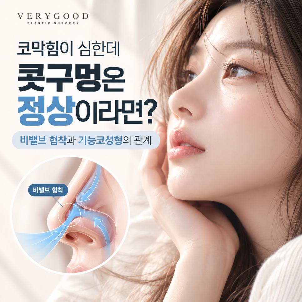 코로 숨을 들이마실 때 답답하다면? 비밸브 협착과 기능코성형 관련 이미지 1