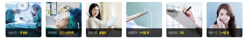 아름다움을 위한 시작, 베리굿성형외과 눈 성형(자연유착) 관련 이미지 3