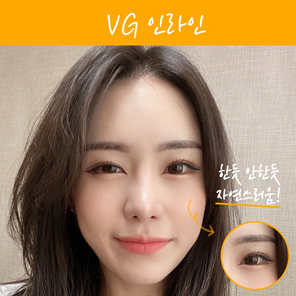 베리굿 성형외과 맞춤별 쌍수👀❤ 관련 이미지 5