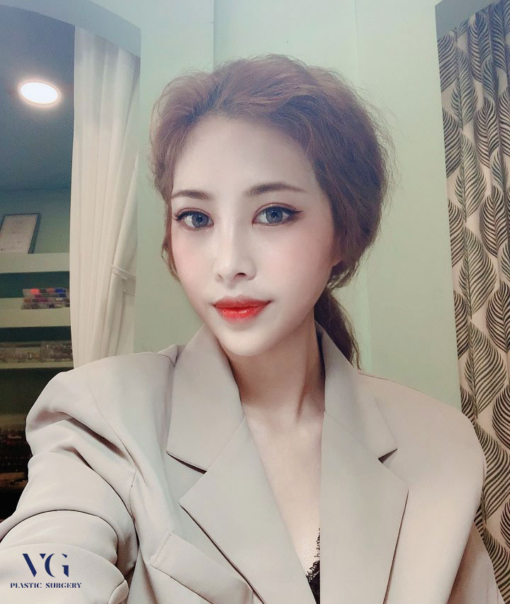 절개쌍꺼풀하고 모두의 시선을 사로잡는 또렷한 눈매 만들자! 관련 이미지 1