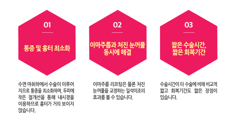 답답한 눈매? 무거운 눈? 베리굿 이마거상전후로 해결👀💖 관련 이미지 2