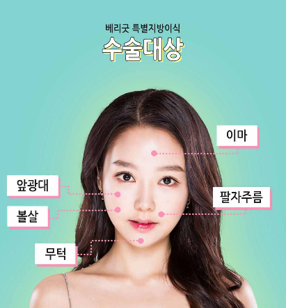 풀 페이스 지방이식으로 어려 보이고 탱탱해지자! 관련 이미지 3