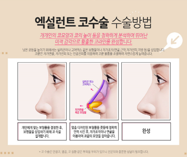 코성형 하나로 세련된 이미지로 관련 이미지 4