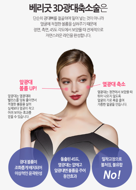 광대축소술 이젠 가리지말고 당당하게! 관련 이미지 2