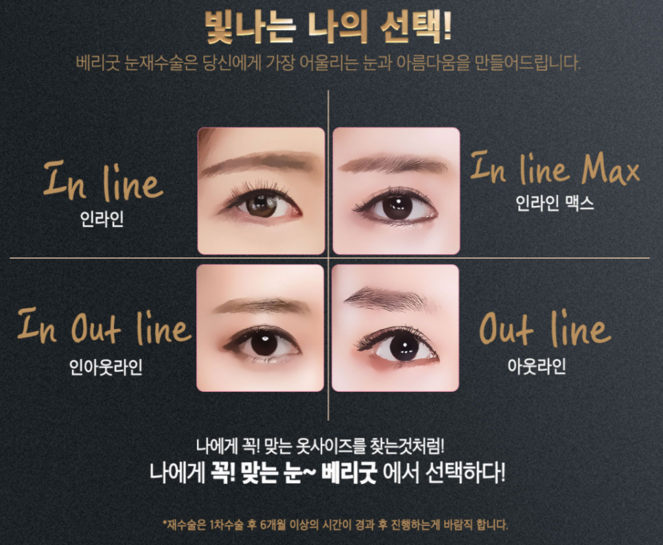 눈재수술도 베리굿하게😍베리굿성형외과 관련 이미지 6