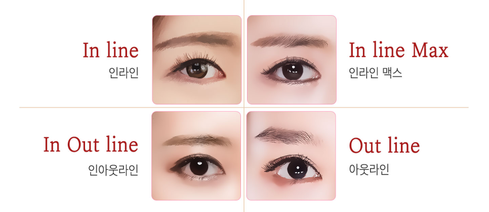 아름다움을 위한 시작, 베리굿성형외과 눈 성형(자연유착) 관련 이미지 6