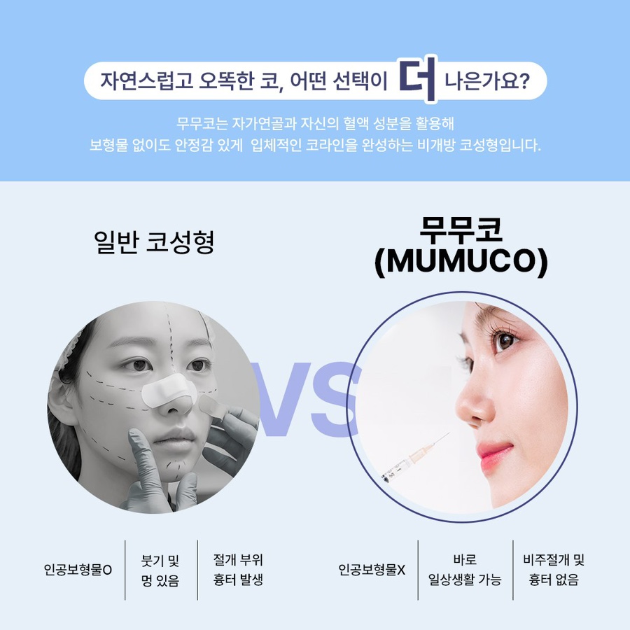회복기간, 비주 절개 , 보형물 없는 코성형 ? 베리굿성형외과 무무코 관련 이미지 3