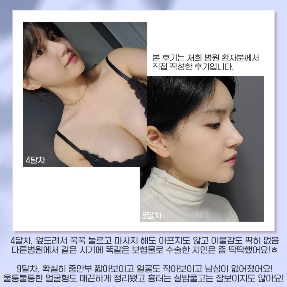 베리굿성형외과가 추천하는 성형별 추천👏 관련 이미지 15