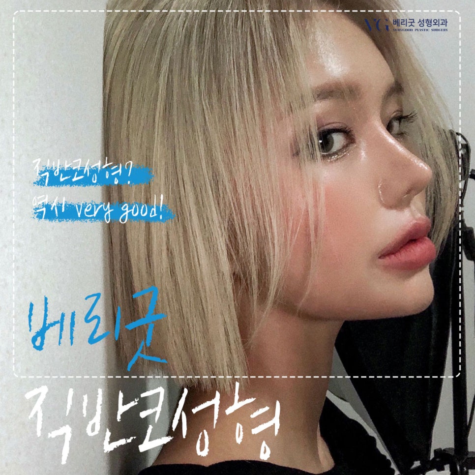 직반코성형? 베리굿성형외과💙 화려하게,자연스럽게✨ 관련 이미지 1