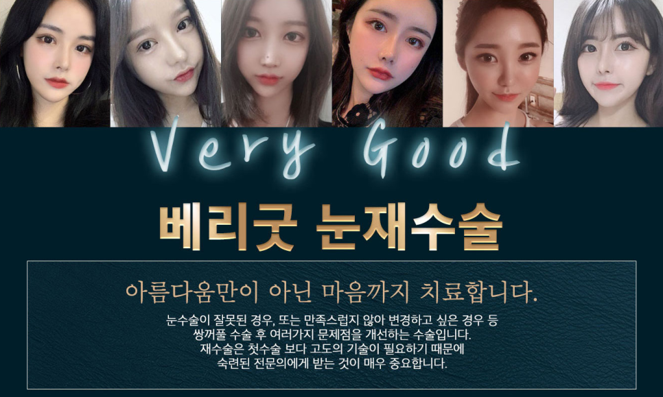 눈재수술도 베리굿하게😍베리굿성형외과 관련 이미지 2