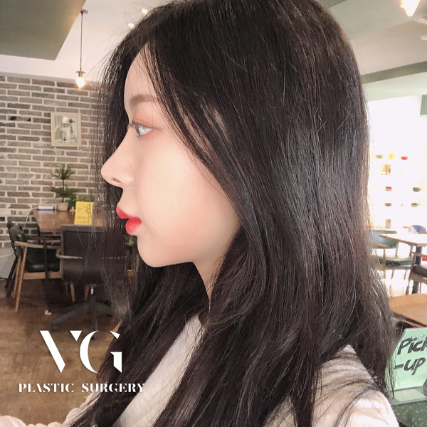 코성형, 개개인의 비율에 맞는 디자인으로 관련 이미지 1