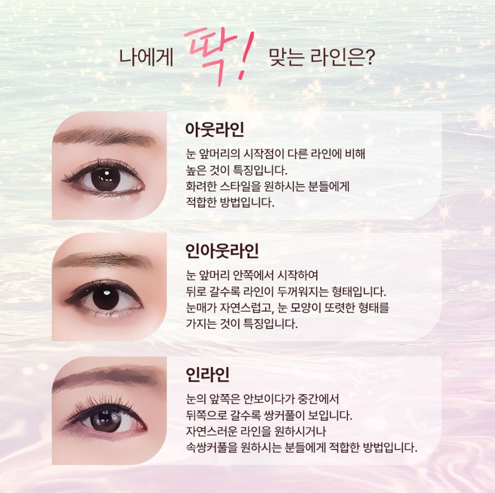 강남 눈재수술 잘하는 곳 비용 후기 알아본다면 , 베리굿성형외과 관련 이미지 3