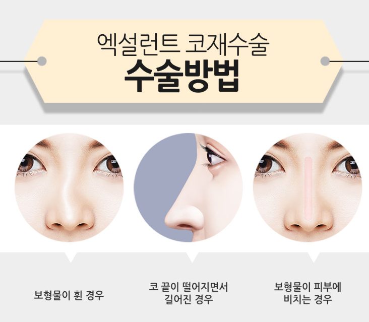 베리굿성형외과 엑설런트 코재수술 이벤트! 내생에 마지막 코수술! 관련 이미지 5