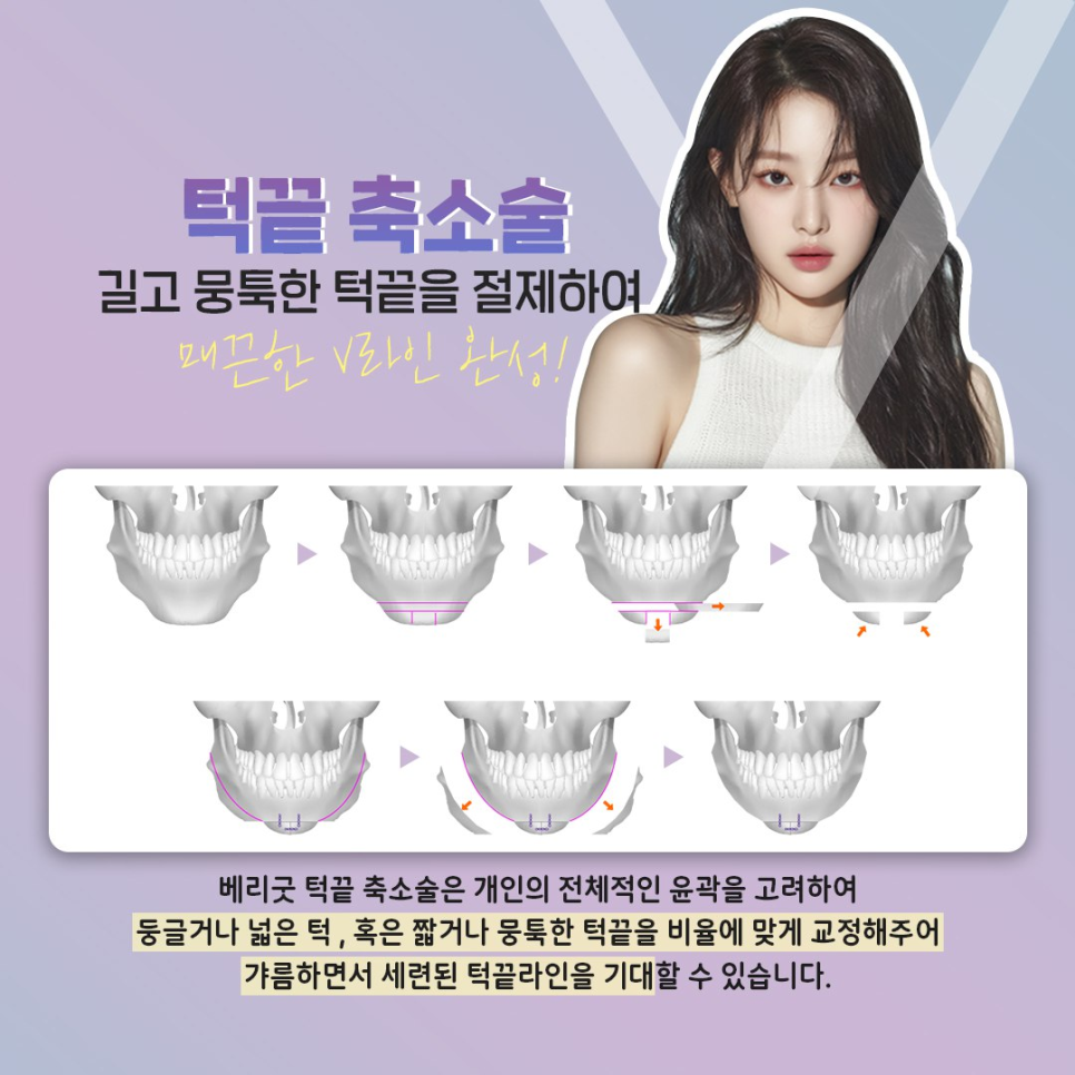 사각턱&middot;광대&middot;턱끝, 강남역 안면윤곽 3종으로 완성하는 황금비율 얼굴 관련 이미지 4