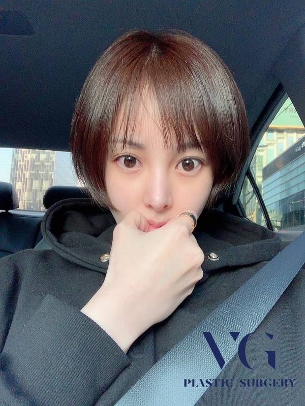 코필러? 턱필러? 필러후기 똑똑하게 알아보고 시술받자! 관련 이미지 3