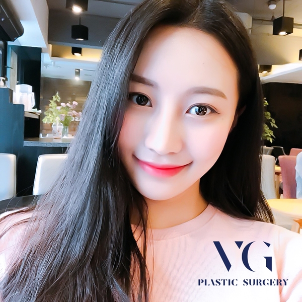 눈밑지방제거하고 환하게 밝히자! 관련 이미지 1