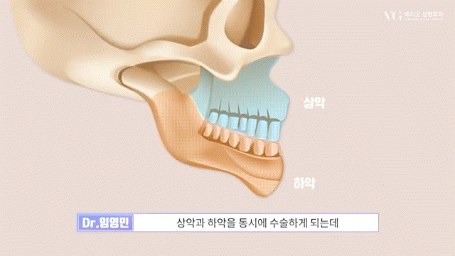 안전성형지향 강남성형외과 , 성형알아볼때 병원 선택법 ? 수혈가능한 병원으로 선택하세요 관련 이미지 10