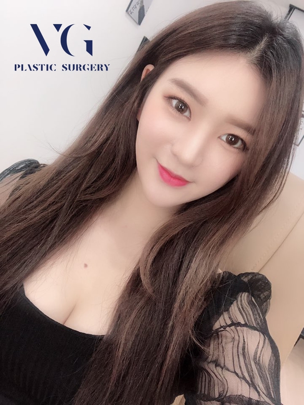 너무 힘든 몸매 관리 지방흡입으로 한번에 S라인되자! 관련 이미지 4