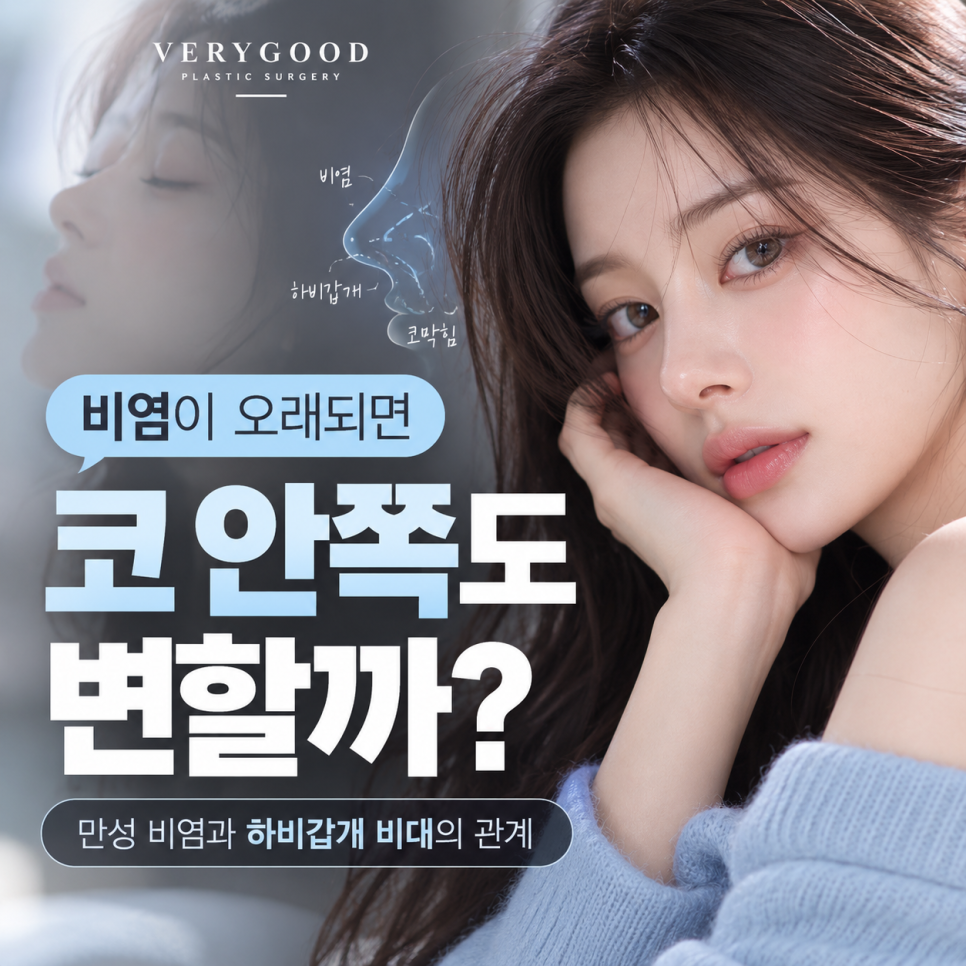 비염이 오래되면 코 안쪽도 변할까? 만성 비염과 하비갑개 비대의 관계 관련 이미지 1