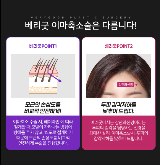 넓은 이마 고민! 이마축소로 해결하자! 관련 이미지 4