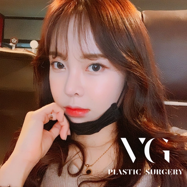 얼굴지방이식으로 내게 어울리는 디자인으로 관련 이미지 1