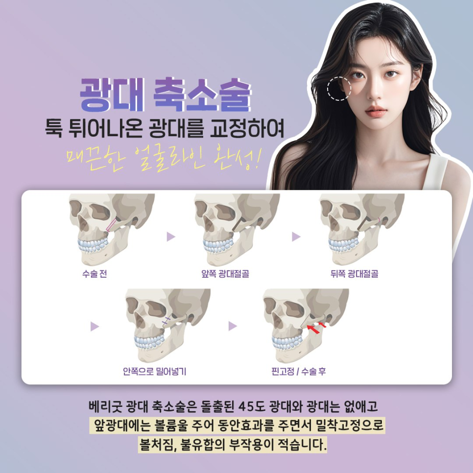 사각턱&middot;광대&middot;턱끝, 강남역 안면윤곽 3종으로 완성하는 황금비율 얼굴 관련 이미지 3