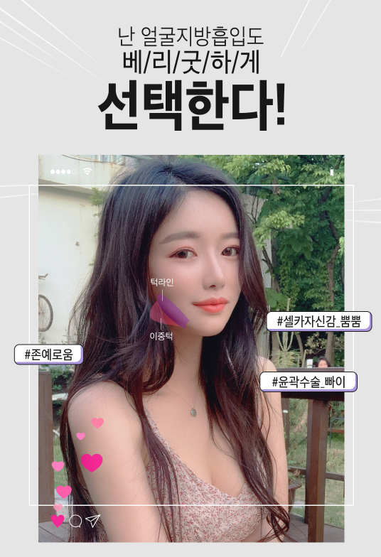 얼굴지방흡입으로 이중턱 박살내자! 관련 이미지 3