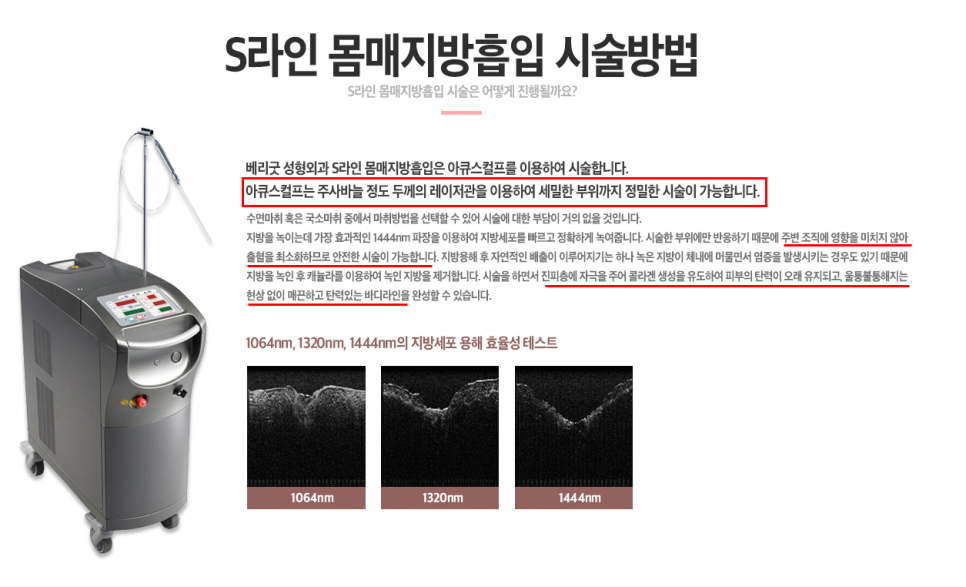 베리굿성형외과에서 뼈팔 만들기🔥베리굿 지방흡입 전후 관련 이미지 6