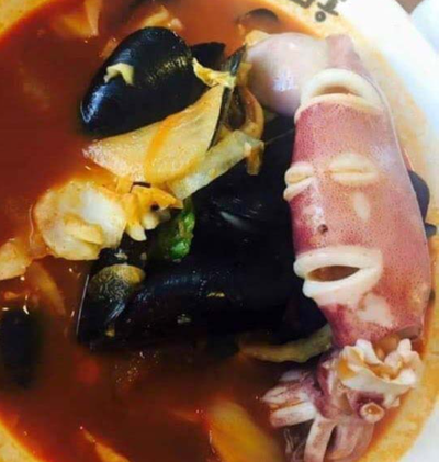 성형수술 시, 주의사항 (수술후편) 관련 이미지 1