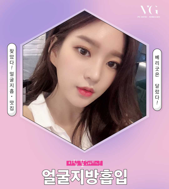 이중턱지방흡입비용 또렷하고 매끈한 얼굴형! 관련 이미지 1