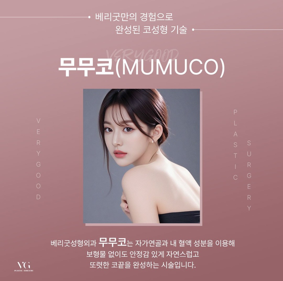 자연스러운 무보형물 코성형, 베리굿성형외과 무무코가 정답인 이유 관련 이미지 2