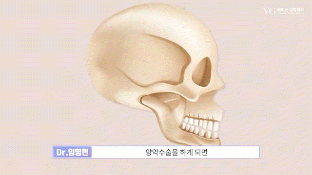 안전성형지향 강남성형외과 , 성형알아볼때 병원 선택법 ? 수혈가능한 병원으로 선택하세요 관련 이미지 9