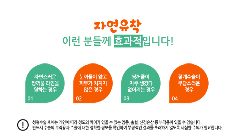 눈성형잘하는곳 찾고있다면? 관련 이미지 2