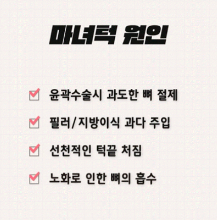 강남역 마녀턱 턱끝거상 , 리프팅원인 수술방법 총정리 관련 이미지 8