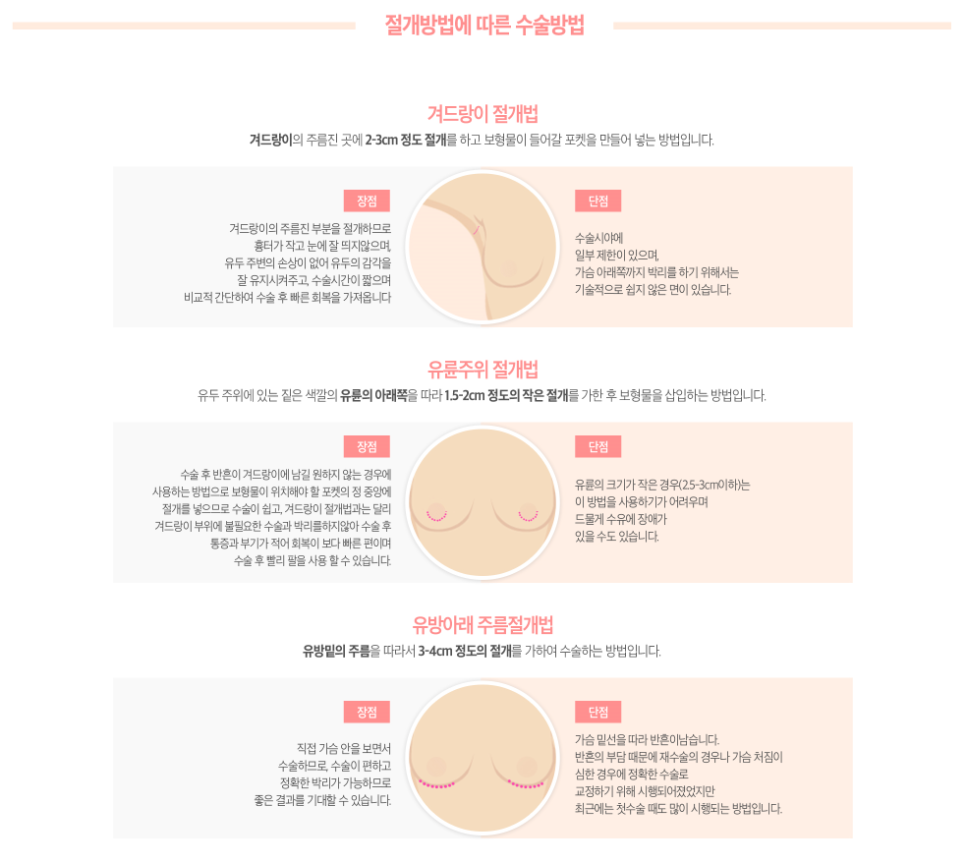 모티바가슴성형 꼭 알아야할 몇가지! 관련 이미지 3