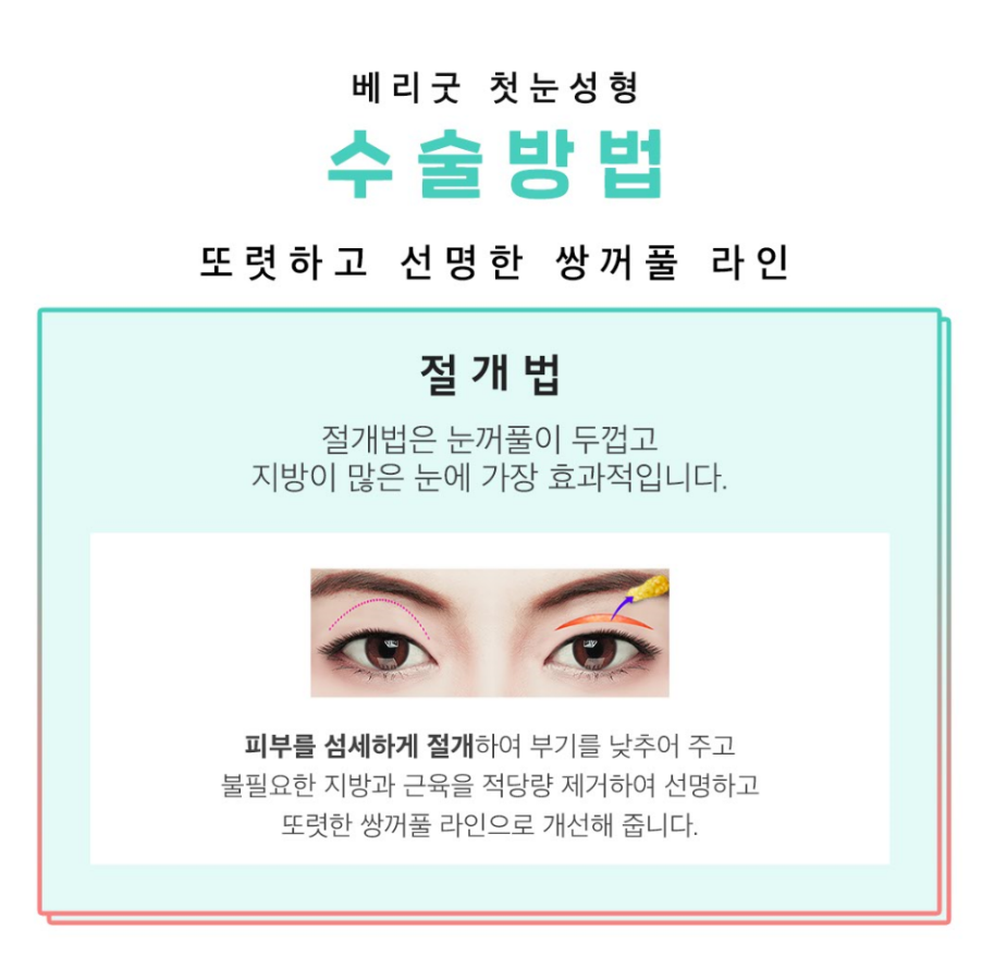 베리굿이 알려드리는 첫눈성형! (절개법) 관련 이미지 2