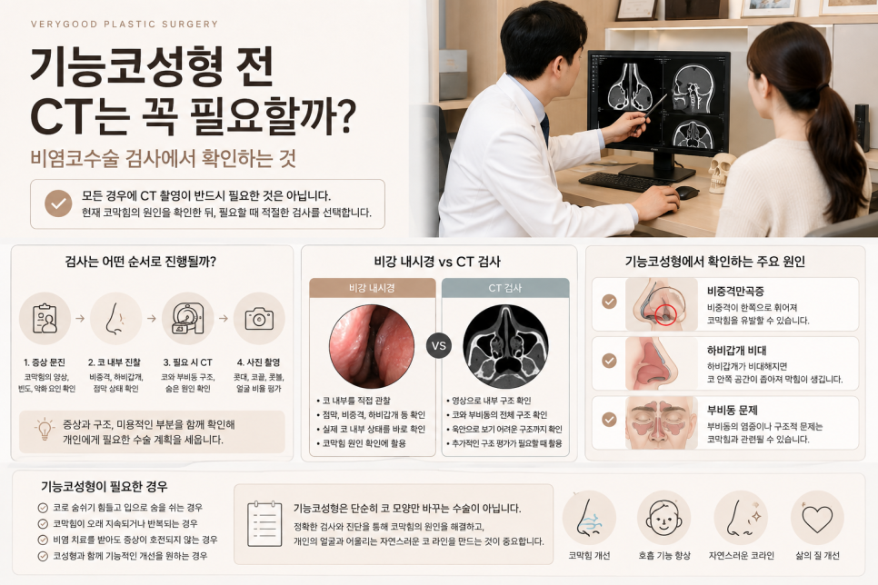 기능코성형 전 CT는 꼭 필요할까? 비염코수술 검사에서 확인하는 것 관련 이미지 2