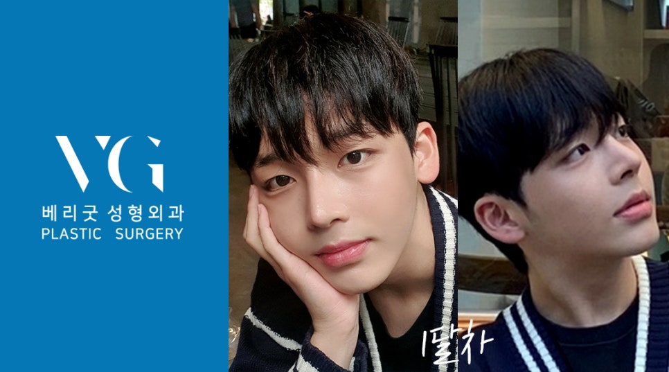 남자인생코 맛집 베리굿성형외과 리얼스토리💌 관련 이미지 4