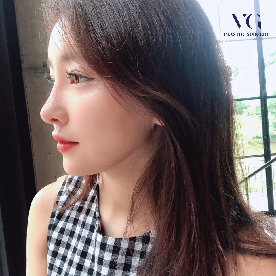 이마거상술로 깊은 이마주름과 처진 눈을 한번에~! 관련 이미지 1