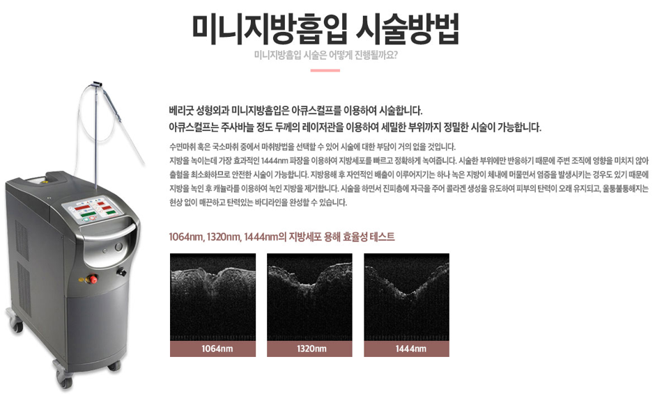 미니지방흡입으로 군살제거하고 당당하게! 관련 이미지 4