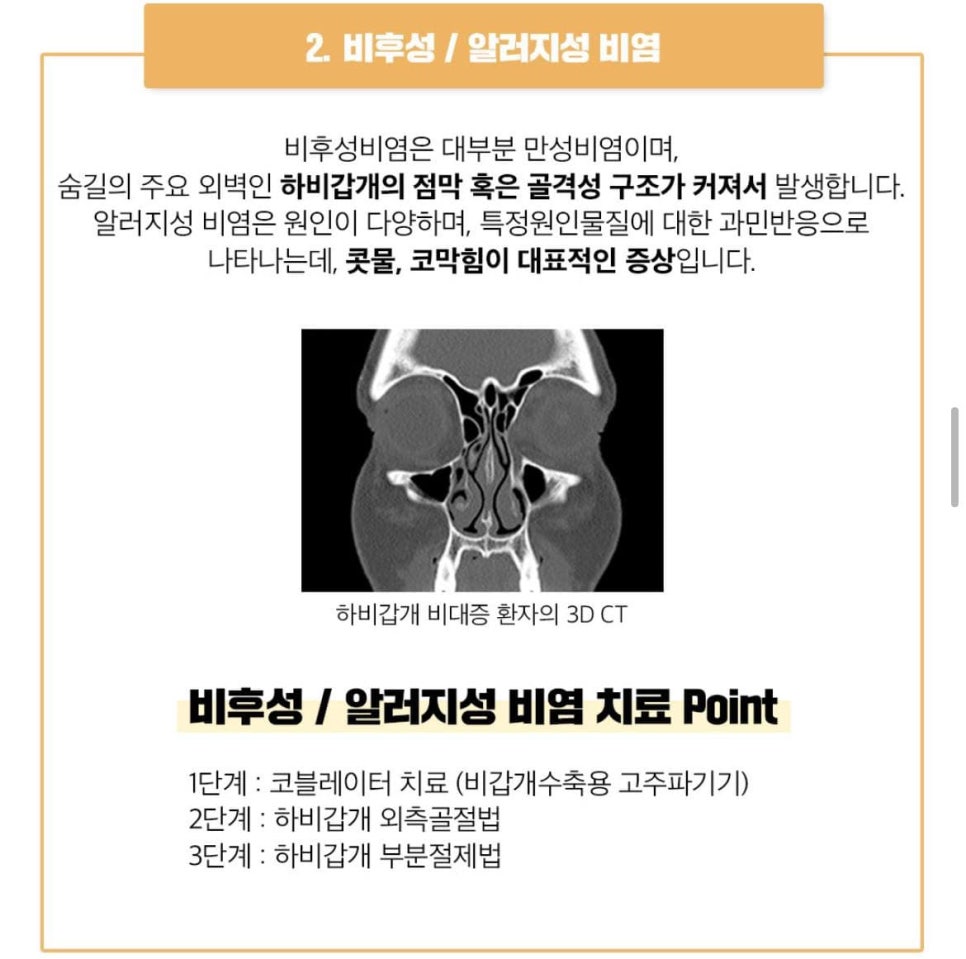 치료와 성형을 한번에[베리굿한 비염코성형] 관련 이미지 4
