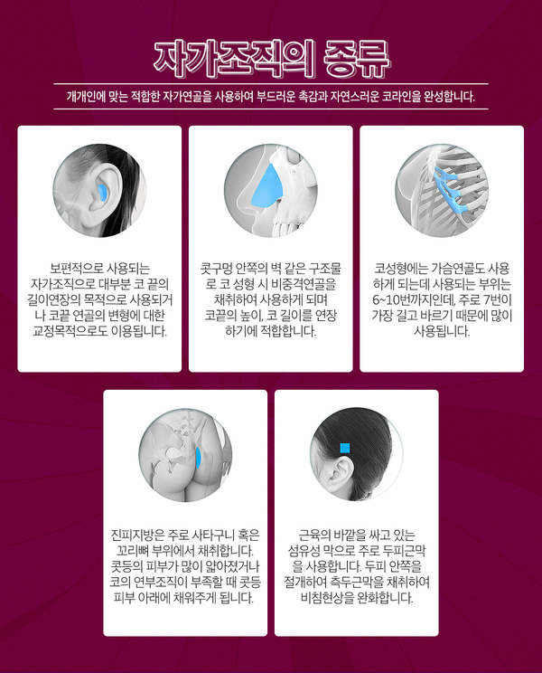 늑연골코재수술, 안전하고 아름답게! 관련 이미지 4