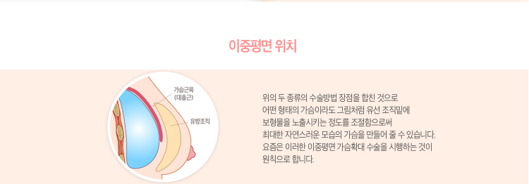 가슴성형 아름다운 라인을 위해 꼼꼼히 알아보자! 관련 이미지 10