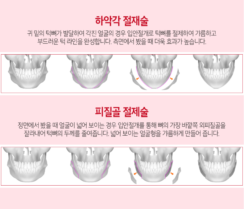 안면윤곽3종 어디서봐도 입체적이고 매끄럽게 관련 이미지 4