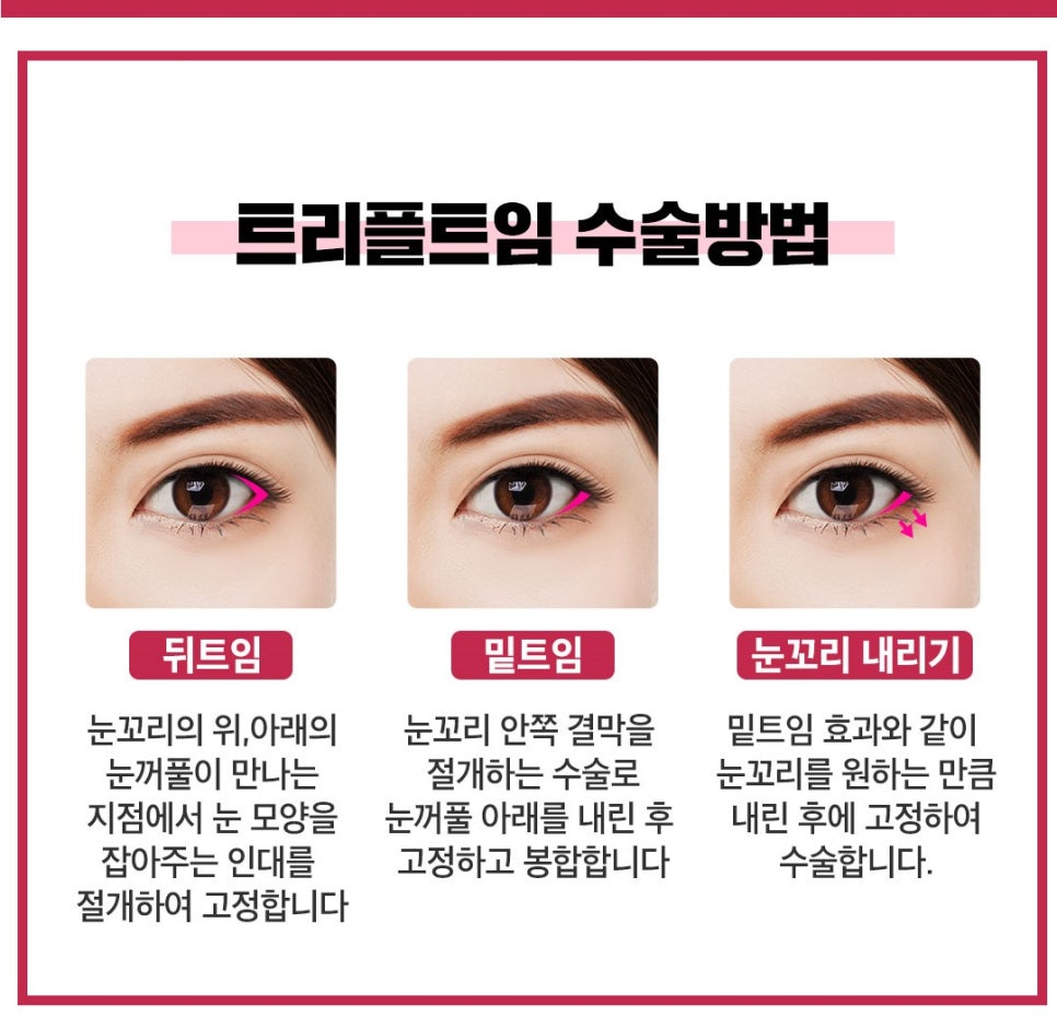 트리플트임도 베리굿하게~❤ 관련 이미지 3