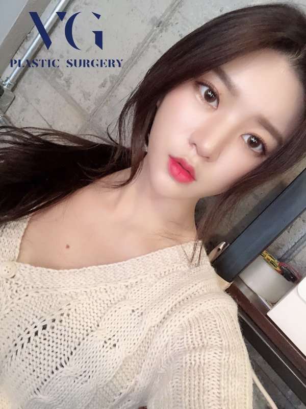 만족스러운 이중턱지방흡입 후기 관련 이미지 1