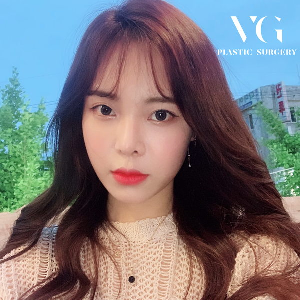 눈밑지방제거로 눈밑을 환하게~ 관련 이미지 1